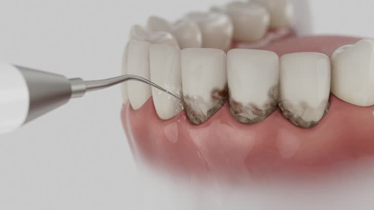 Trusted Dental Crowns And Bridges service in Hampstead, NC - Dentist Open Now